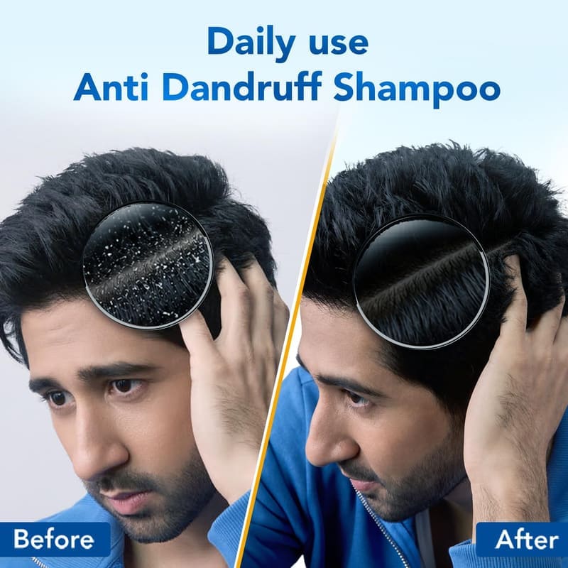 Scalpe Pro Daily Anti-Dandruff Shampoo in use